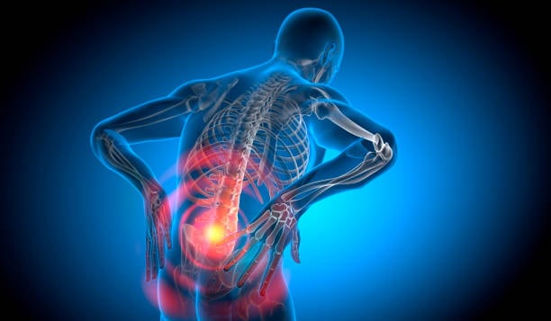 lower back pain illustration showing spinal stress treated by a walk-in chiropractor in Tulsa